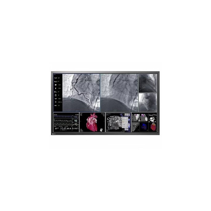 RadiForce LS580W