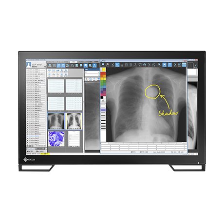 RadiForce MS236WT-A