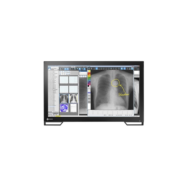 RadiForce MS236WT-A